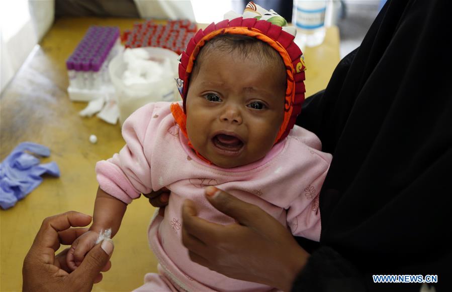 YEMEN-SANAA-WAR-AFFECTED CHILDREN